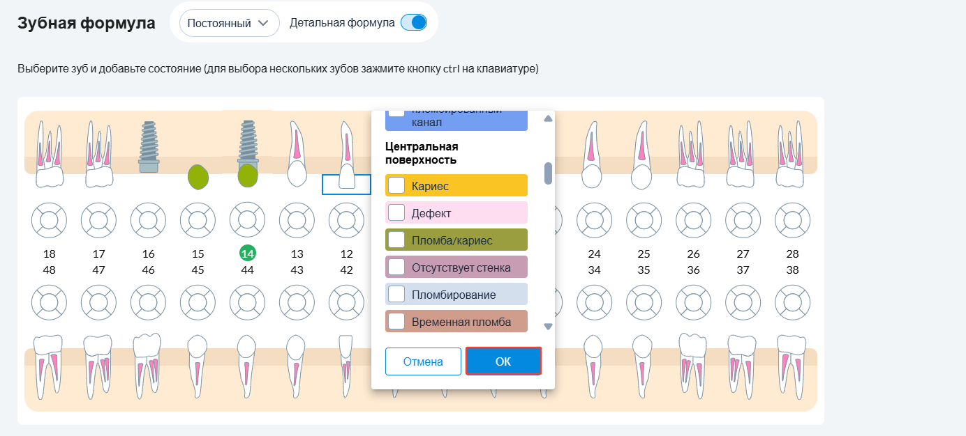 область_под_коронкой.png